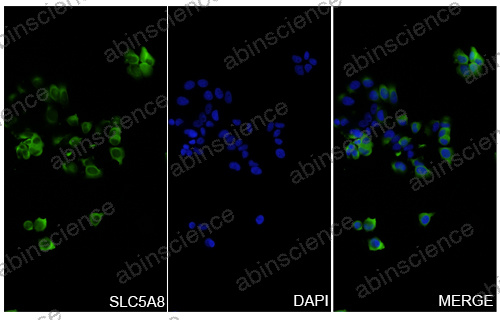 Anti-Human SLC5A8 Recombinant Nanobody (SAA0962)