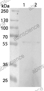 Anti-Human STAMP2/STEAP4 Recombinant Antibody (SRR0361)