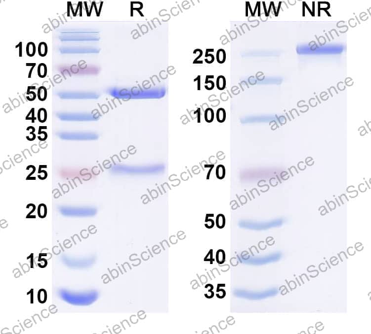 Anti-Human L3MBTL3 IP Recombinant Antibody (SAA0209)