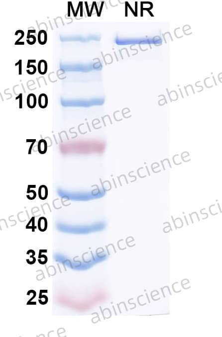Anti-Human HERV-K Env/ERVK-6 Recombinant Antibody (Kenv-4)