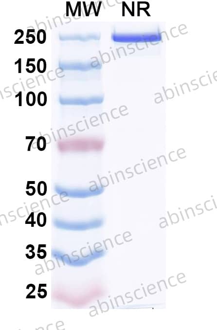 Anti-Human HERV-K Env/ERVK-6 Recombinant Antibody (Kenv-6)