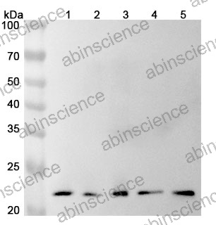 Anti-Human GADD45GIP1 Polyclonal Antibody
