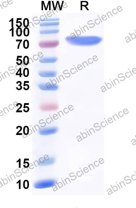 Human SEMA4C Recombinant Protein (C-His)