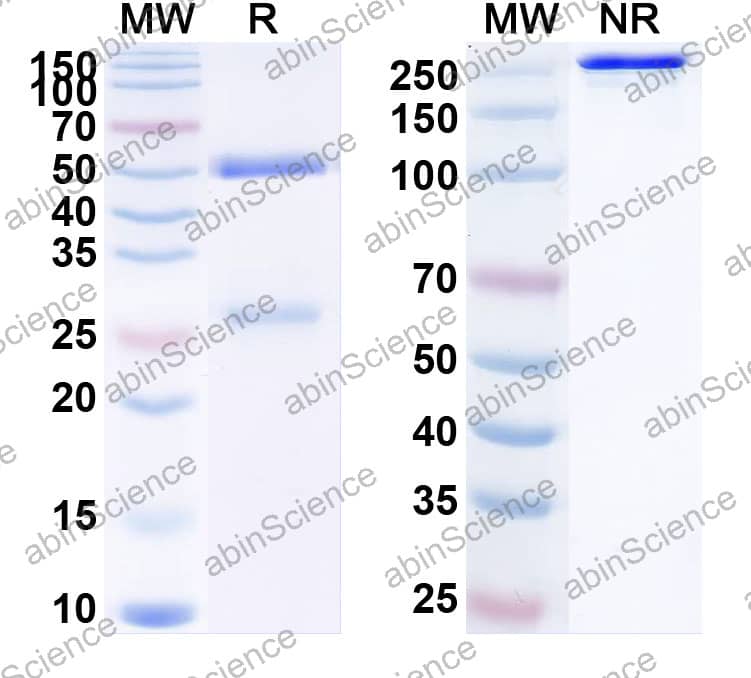 Anti-Human SIGLEC15/CD33L3 Antibody (A9E8)