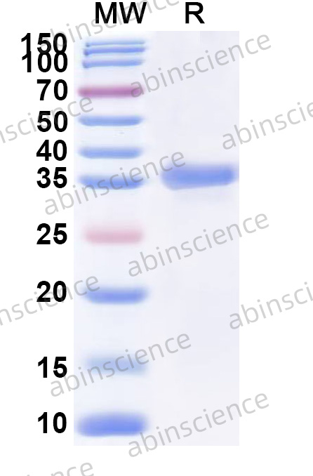 Recombinant Human NTRK3/TrkC Protein, N-His