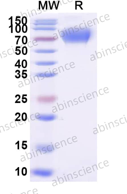 Human DNAM-1/CD226 Recombinant Protein (C-Fc)