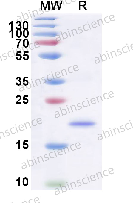 Human P2RY14 Recombinant Protein (N-His)