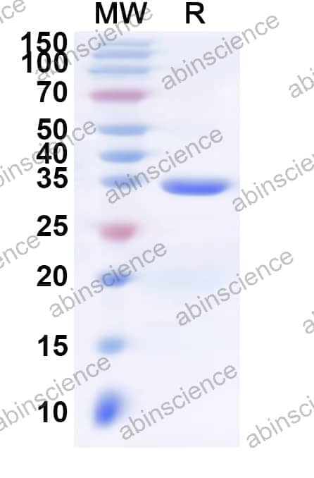Human C3AR1 Recombinant Protein (N-His-KSI)