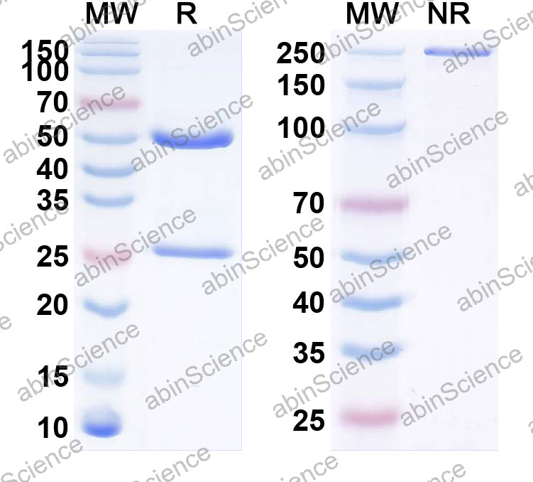 Anti-Human IRF4 Monoclonal Antibody (1A518)