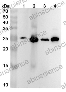 Anti-GSTA3 Polyclonal Antibody