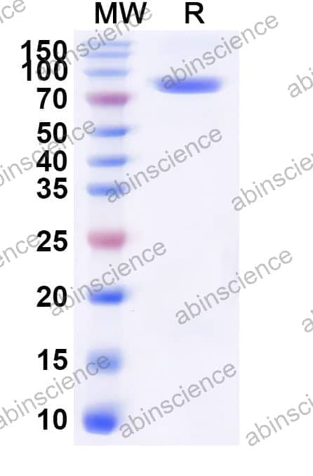 Human RAGE/AGER Recombinant Protein (C-Fc)