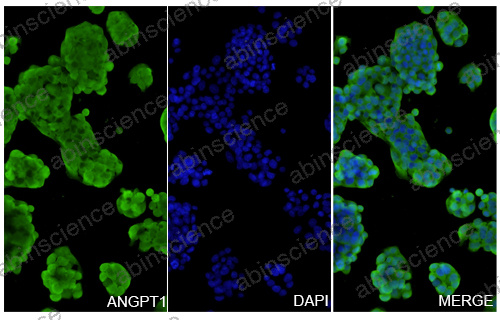 Anti-Human ANGPT1 Recombinant Nanobody (SAA1256)