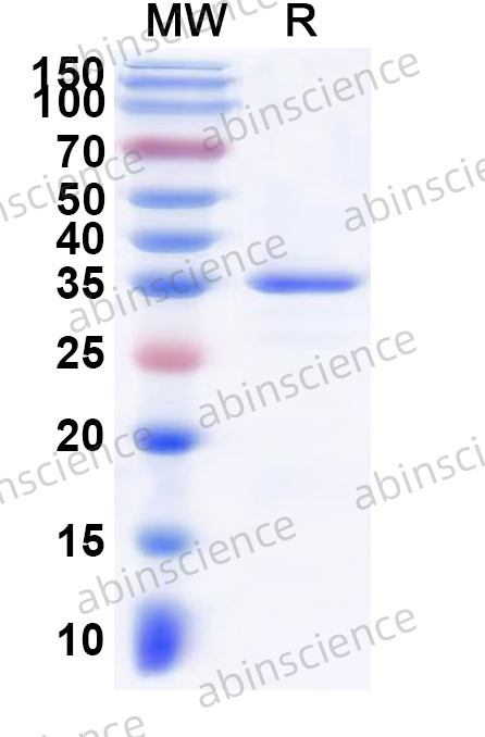 Human FOXD1/FOXD2 Recombinant Protein (N-GST & C-His)