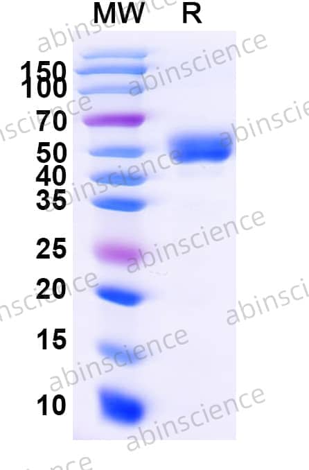 Human CD337/NCR3 Recombinant Protein (C-Fc)