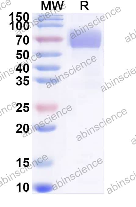 Human ANGPT2/Ang2 Recombinant Protein (C-His)
