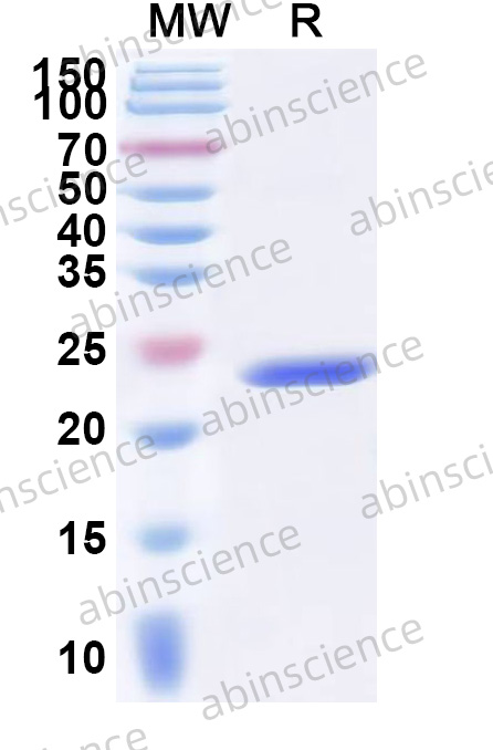 Human ACSL4 Recombinant Protein (N-His)