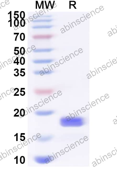 Human CD300LB Recombinant Protein (N-His)