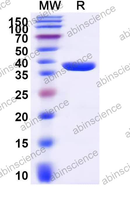 Human DVL1 Recombinant Protein (N-GST&C-His)