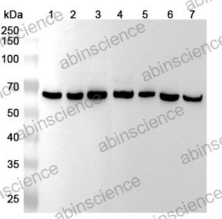 Anti-NARS1 Polyclonal Antibody