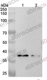 Anti-Human CACNG3 Polyclonal Antibody