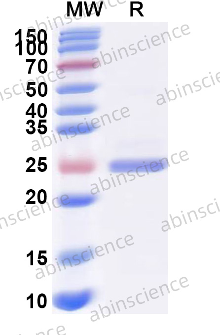 Human APOL1 Recombinant Protein (N-His)