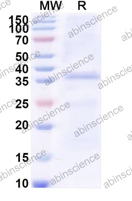 Human CD327/SIGLEC6 Recombinant Protein (C-His)
