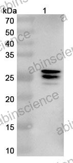 Anti-Human DCX Nanobody (SAA1021)