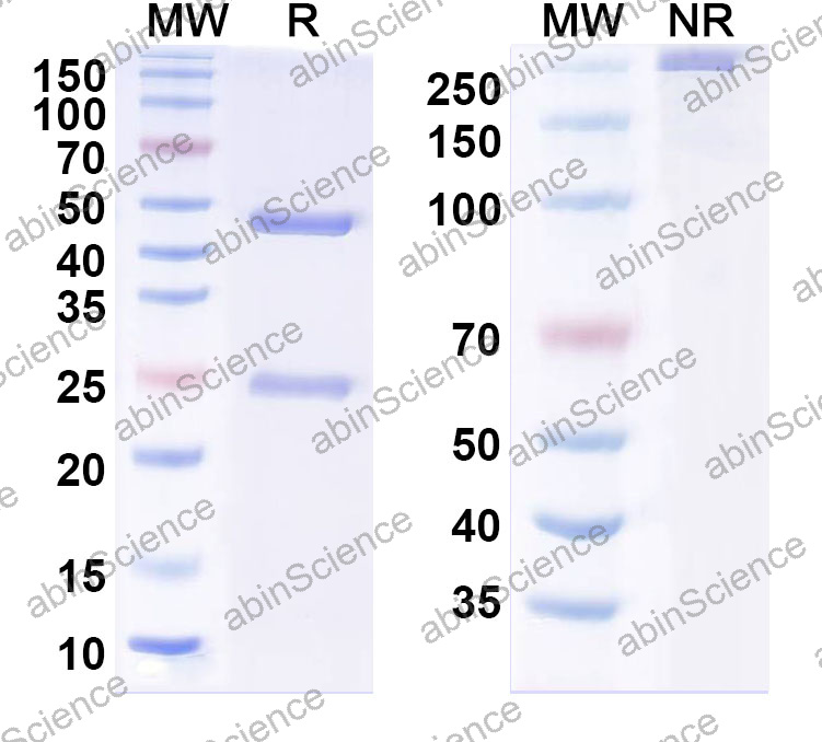 Anti-Human DCX Monoclonal Antibody (1A538)