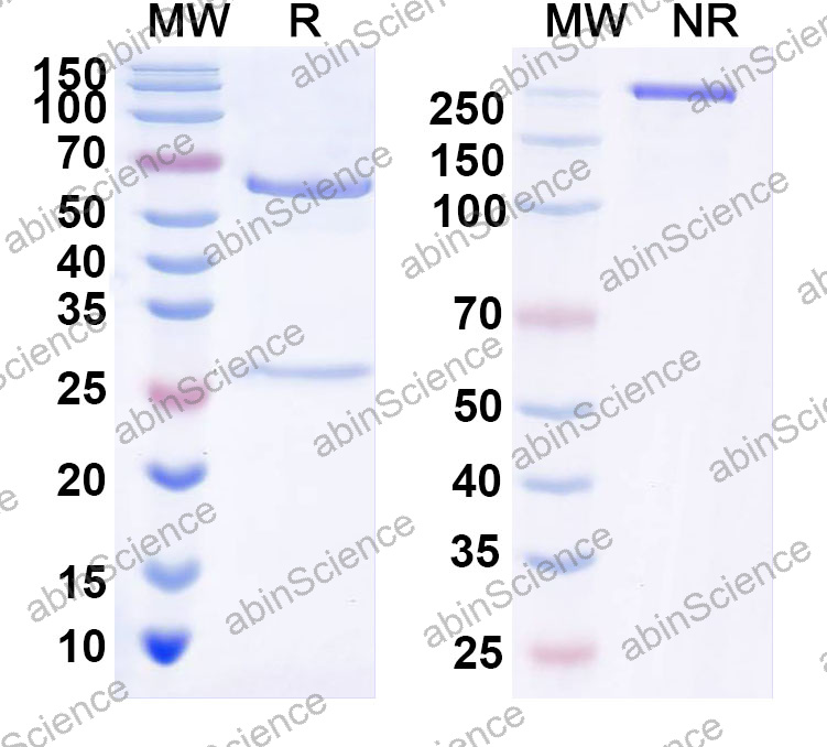 Anti-Human DCX Monoclonal Antibody (1A539)