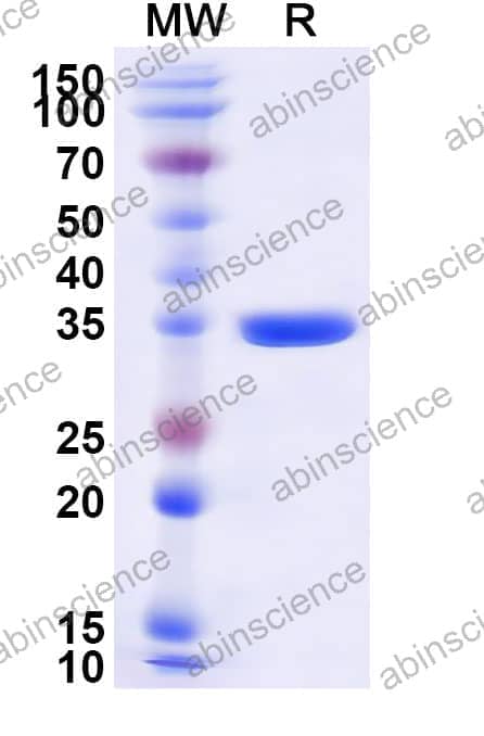 Human DVL2 Recombinant Protein (N-GST&C-His)