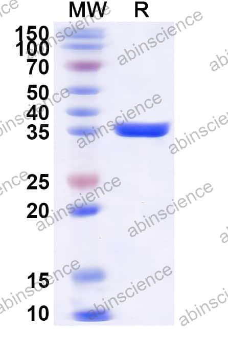 Human DVL2 Recombinant Protein (N-GST&C-His)