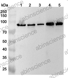 Anti-TRPV5 Polyclonal Antibody