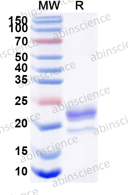 Anti-Human CD366/HAVCR2/TIM-3 Recombinant Nanobody, C-Sortase tag (SAA1348)