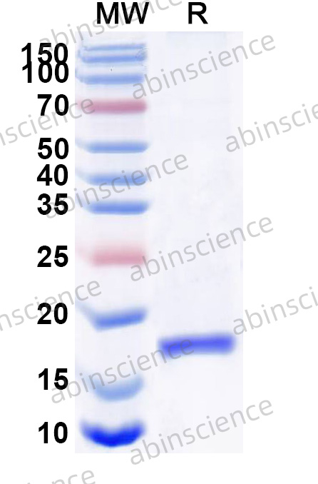 Anti-Human CD366/HAVCR2/TIM-3 Recombinant Nanobody, C-Sortase tag (R53)