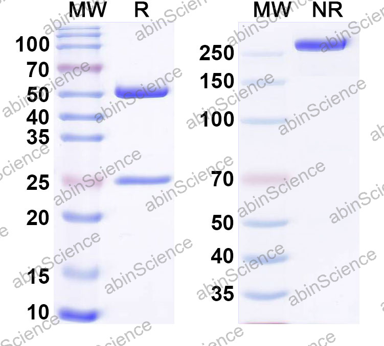 Anti-Human STING1/TMEM173 Monoclonal Antibody (1A647)