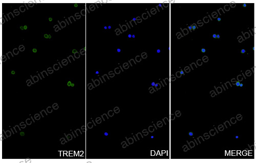 Anti-Human TREM2 Recombinant Nanobody (SAA1136)