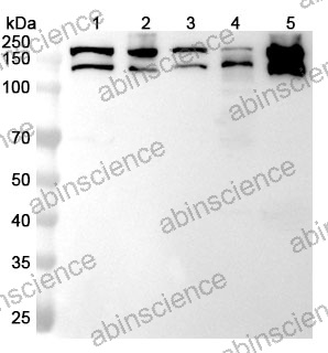 Anti-Human KTN1 Polyclonal Antibody