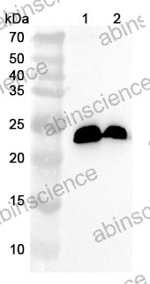Anti-ZFAND6 Polyclonal Antibody