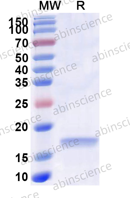 Human LPCAT3 Recombinant Protein (N-His)