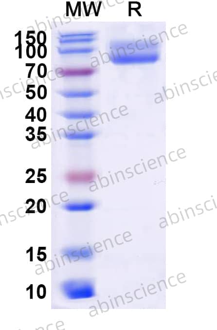 Human CD172g/SIRPG Recombinant Protein (C-Fc)