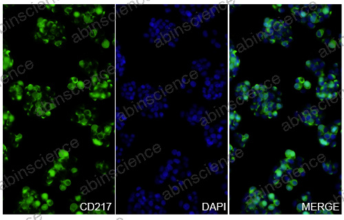 Anti-Human IL-17RA/IL-17R Recombinant Nanobody (SAA1266)