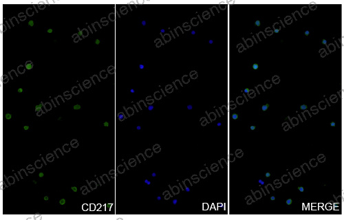 Anti-Human IL-17RA/IL-17R Recombinant Nanobody (SAA1266)