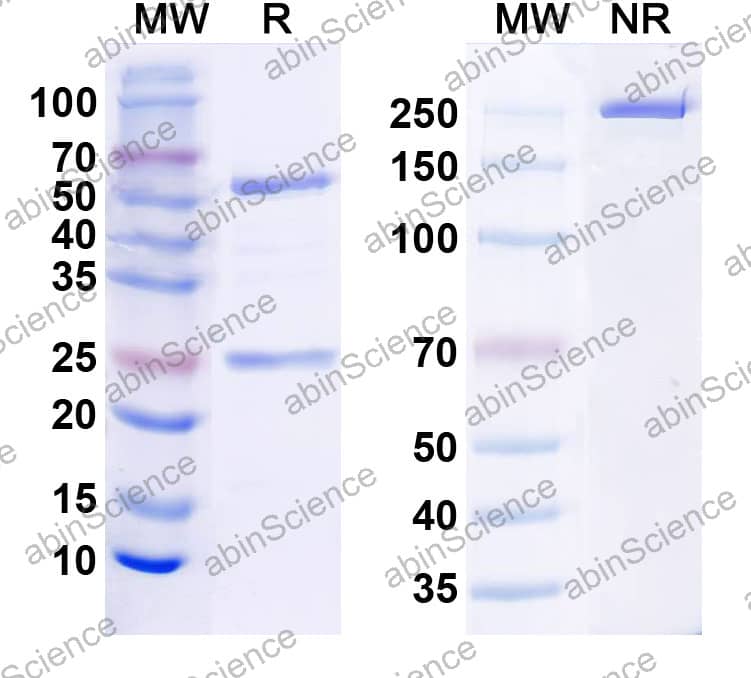 Anti-Human KLB/Beta-klotho Monoclonal Antibody (1A138)