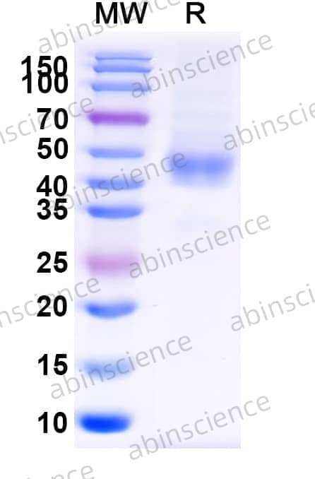 Human CD84/SLAMF5 Recombinant Protein (C-His)