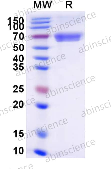 Human CD84/SLAMF5 Recombinant Protein (C-Fc)