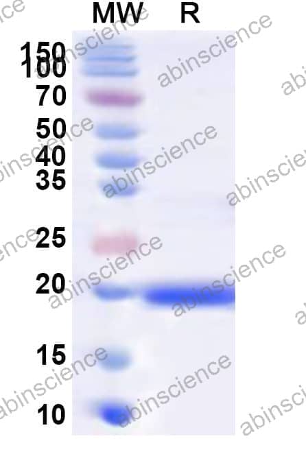 Human IL1F10 Recombinant Protein (N-His)