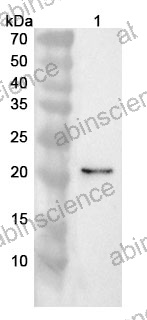 Anti-Human DKK4 Polyclonal Antibody