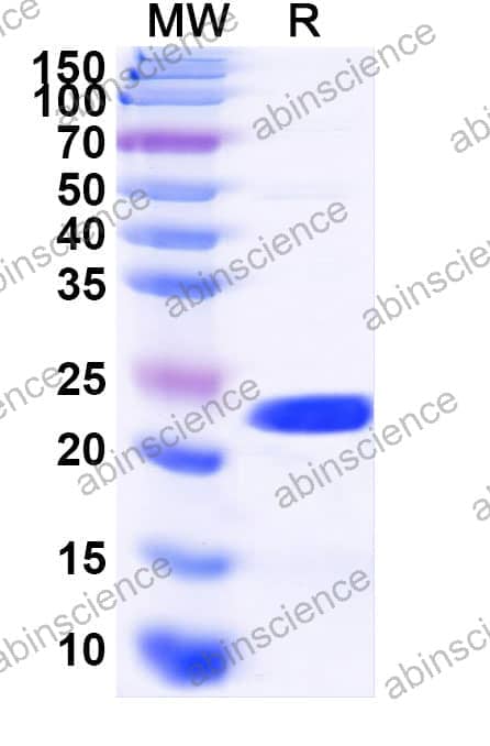 Human MDA5 Recombinant Protein (C-His)