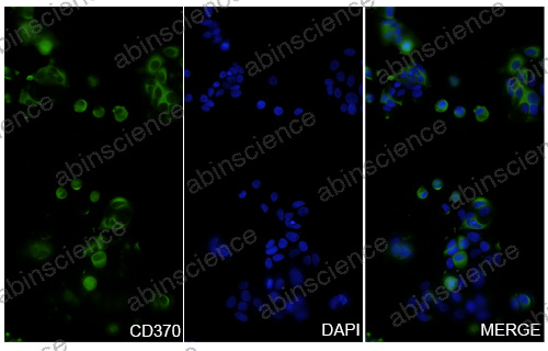 Anti-Human CD370/CLEC9a Recombinant Nanobody (SAA2549)