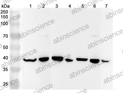 Anti-ACAT2 Polyclonal Antibody